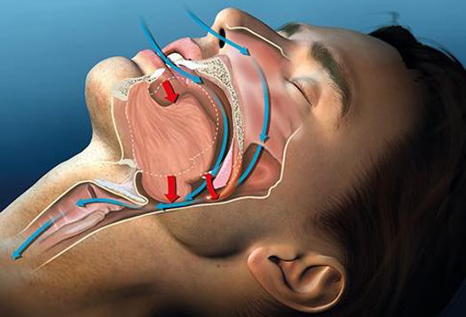 New Image Orthodontics | Oral Exams, Dental Bridges and Sleep Apnea