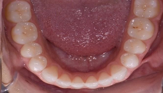 New Image Orthodontics | Dental Bridges, Oral Exams and Dental Fillings