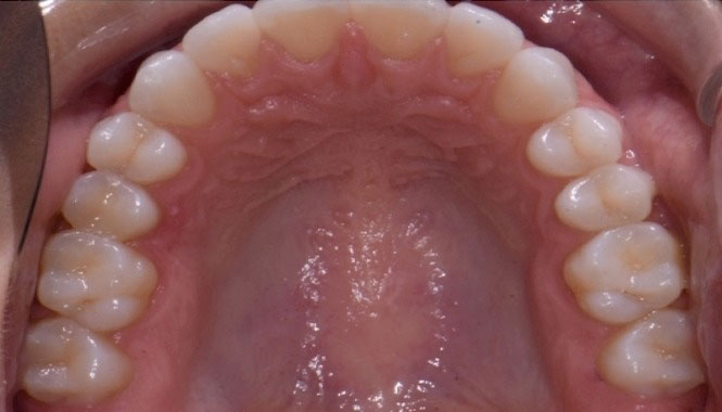 New Image Orthodontics | Teeth Whitening, Crowns and TMJ Disorders