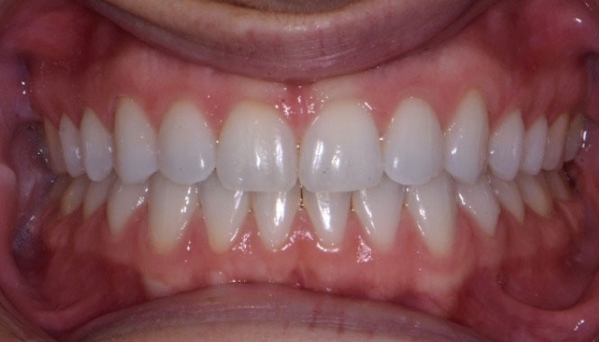 New Image Dental and Orthodontics | Oral Exams, Crowns and Dentures