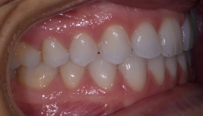 New Image Orthodontics | Dental Fillings, Sleep Apnea and Dentures