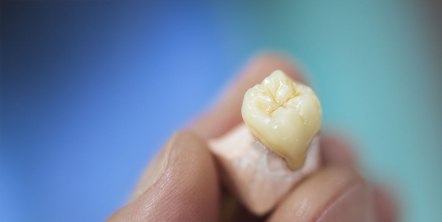 New Image Orthodontics | Dental Fillings, Sleep Apnea and Teeth Whitening