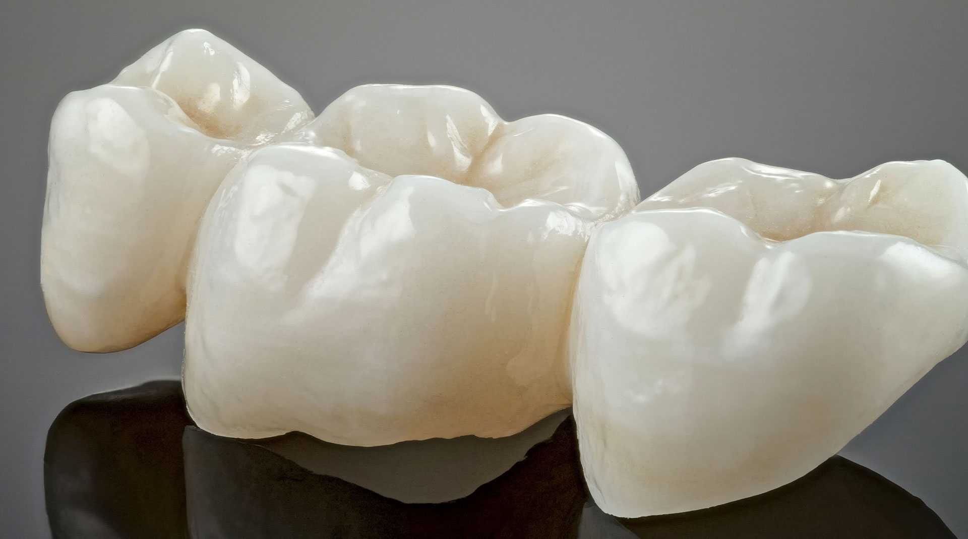 New Image Dental and Orthodontics | Crowns, Dental Fillings and Dental Cleanings