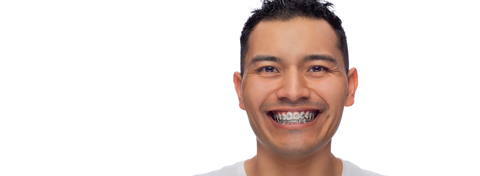 New Image Dental and Orthodontics | Dental Fillings, Crowns and Dentures