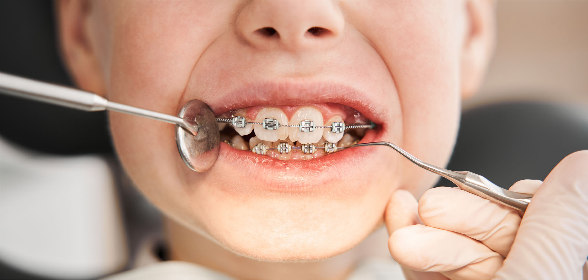 New Image Dental and Orthodontics | Teeth Whitening, Dentures and Dental Fillings