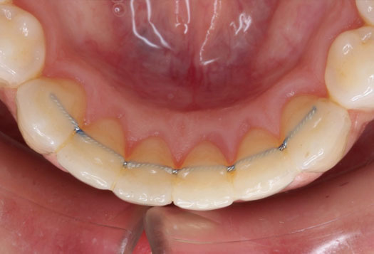 New Image Dental and Orthodontics | Dentures, Teeth Whitening and TMJ Disorders