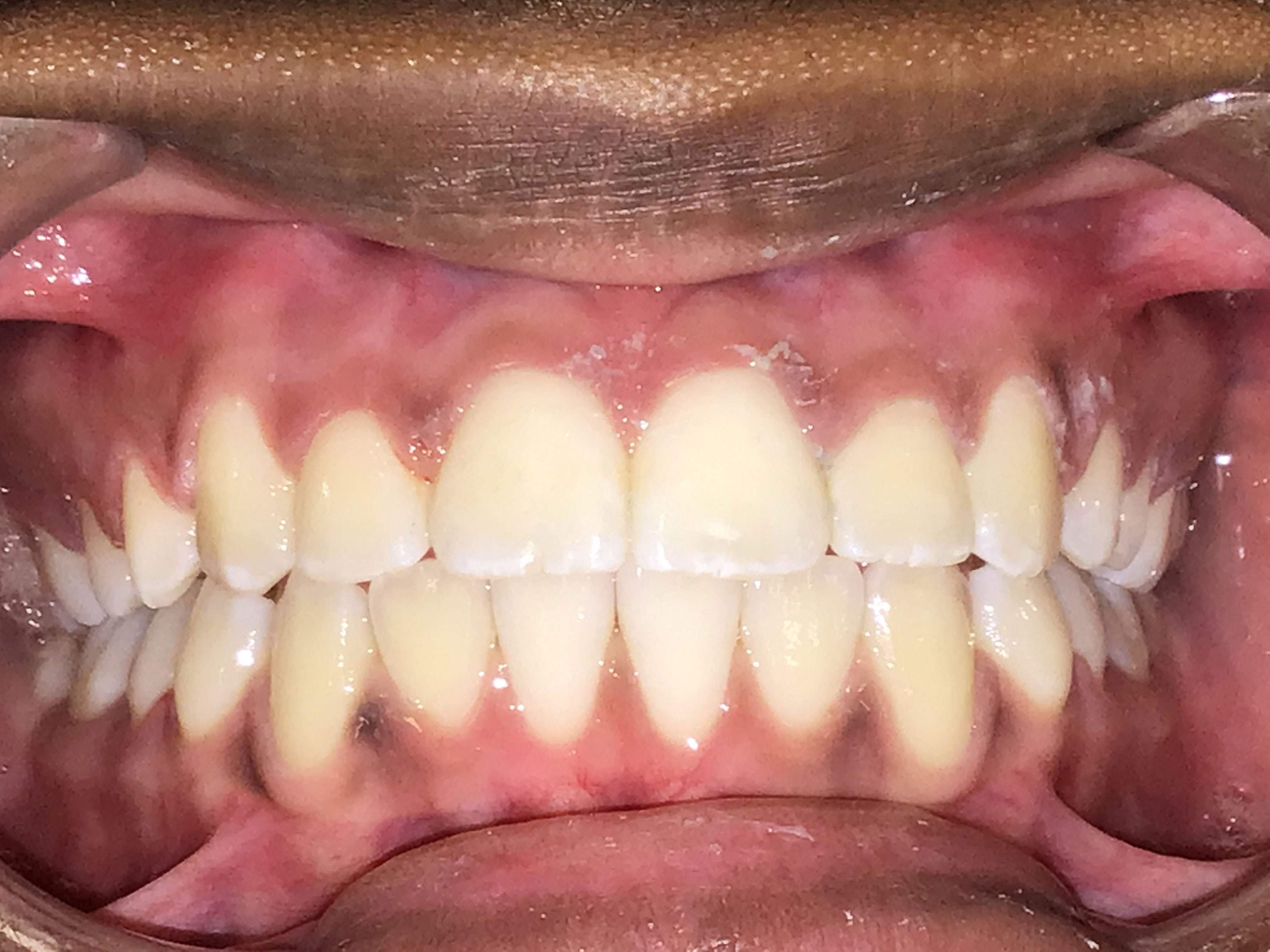 New Image Orthodontics | TMJ Disorders, Dental Cleanings and Sleep Apnea