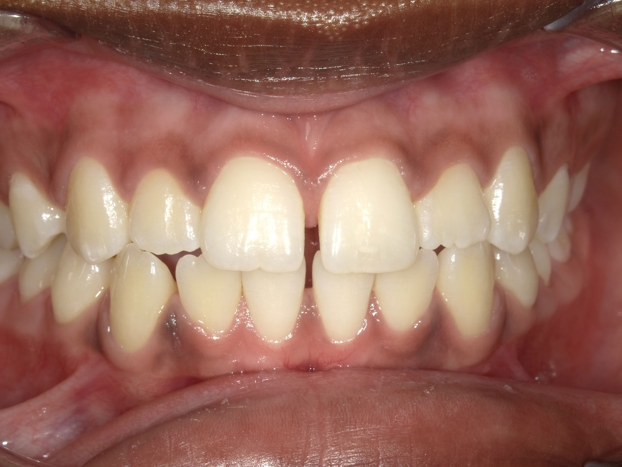 New Image Orthodontics | Dental Fillings, Teeth Whitening and Dentures