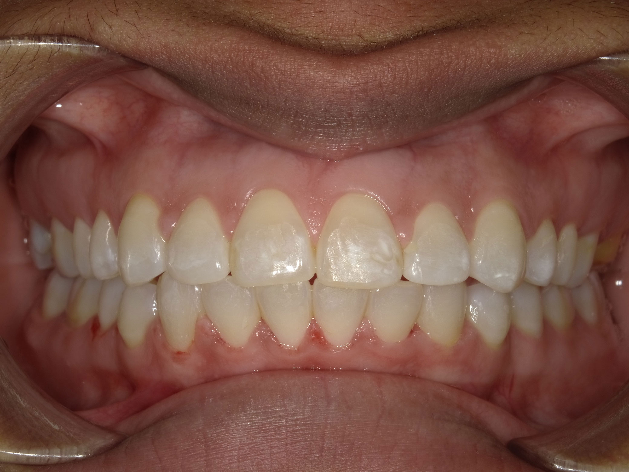 New Image Orthodontics | Dental Fillings, Crowns and Oral Exams