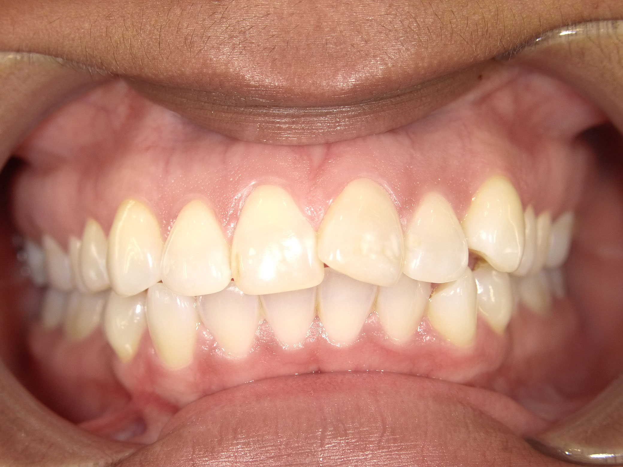 New Image Orthodontics | Dentures, Dental Cleanings and Dental Bridges