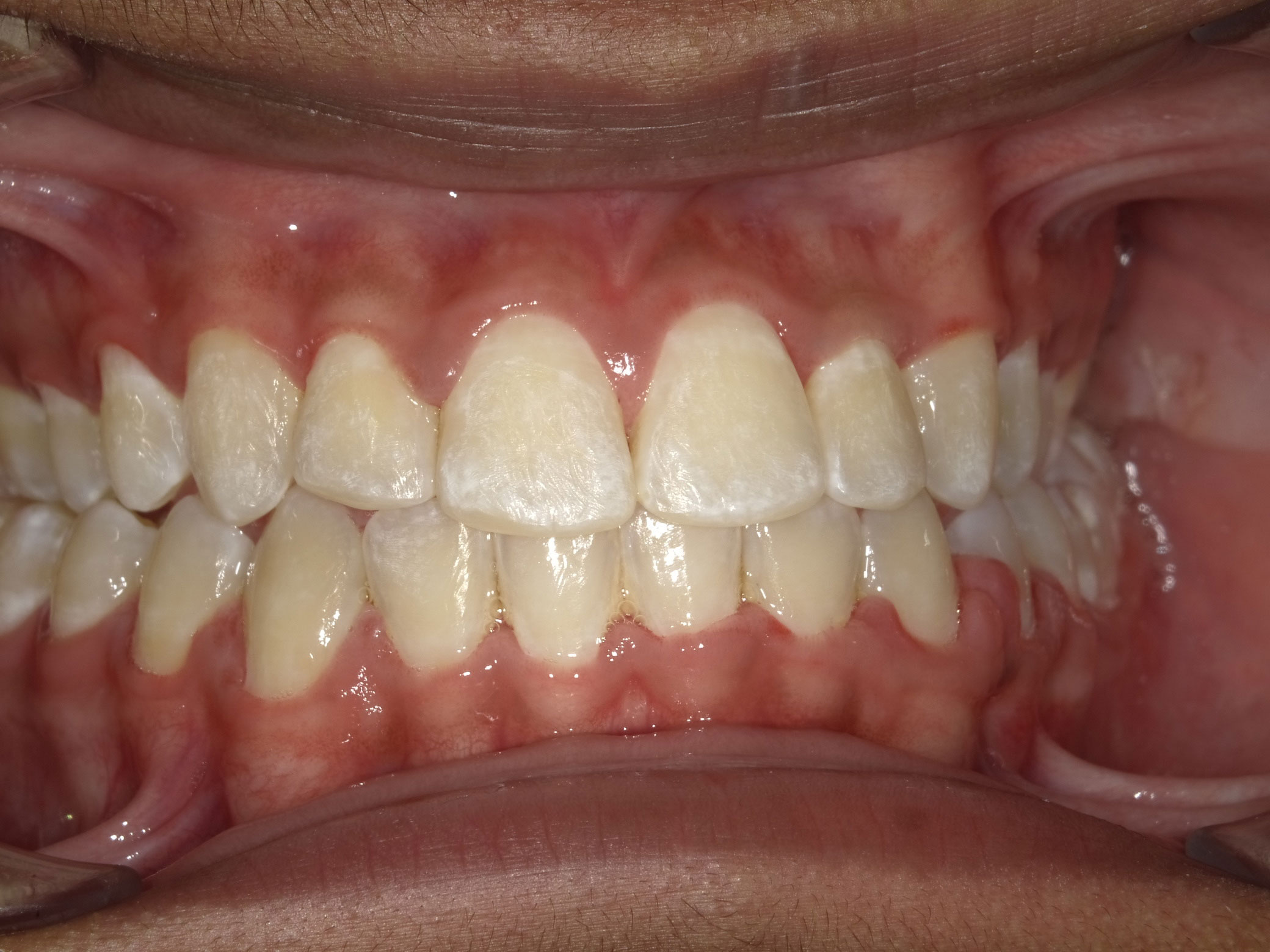 New Image Orthodontics | Sleep Apnea, TMJ Disorders and Oral Exams