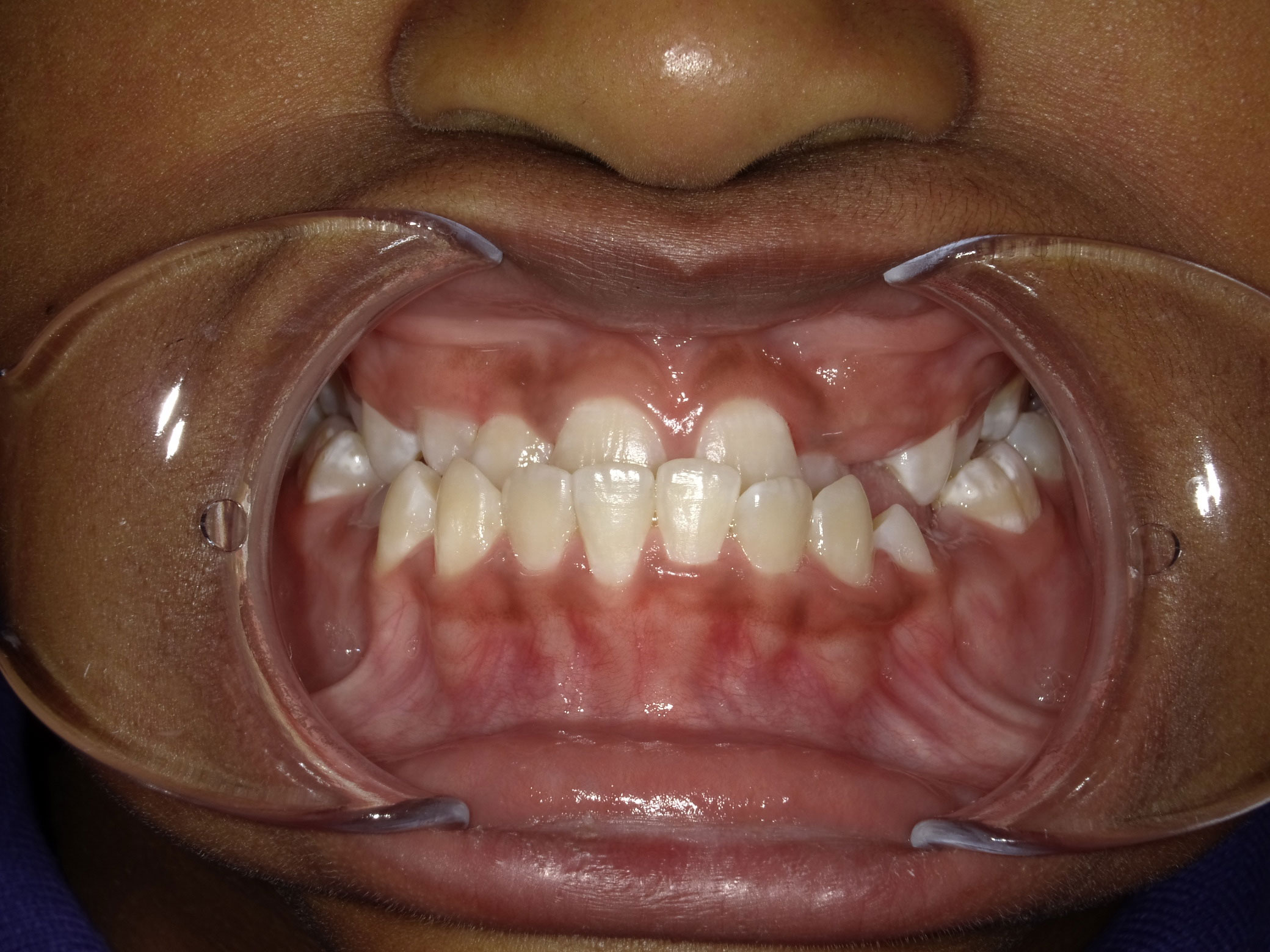 New Image Orthodontics | Teeth Whitening, Dental Fillings and TMJ Disorders