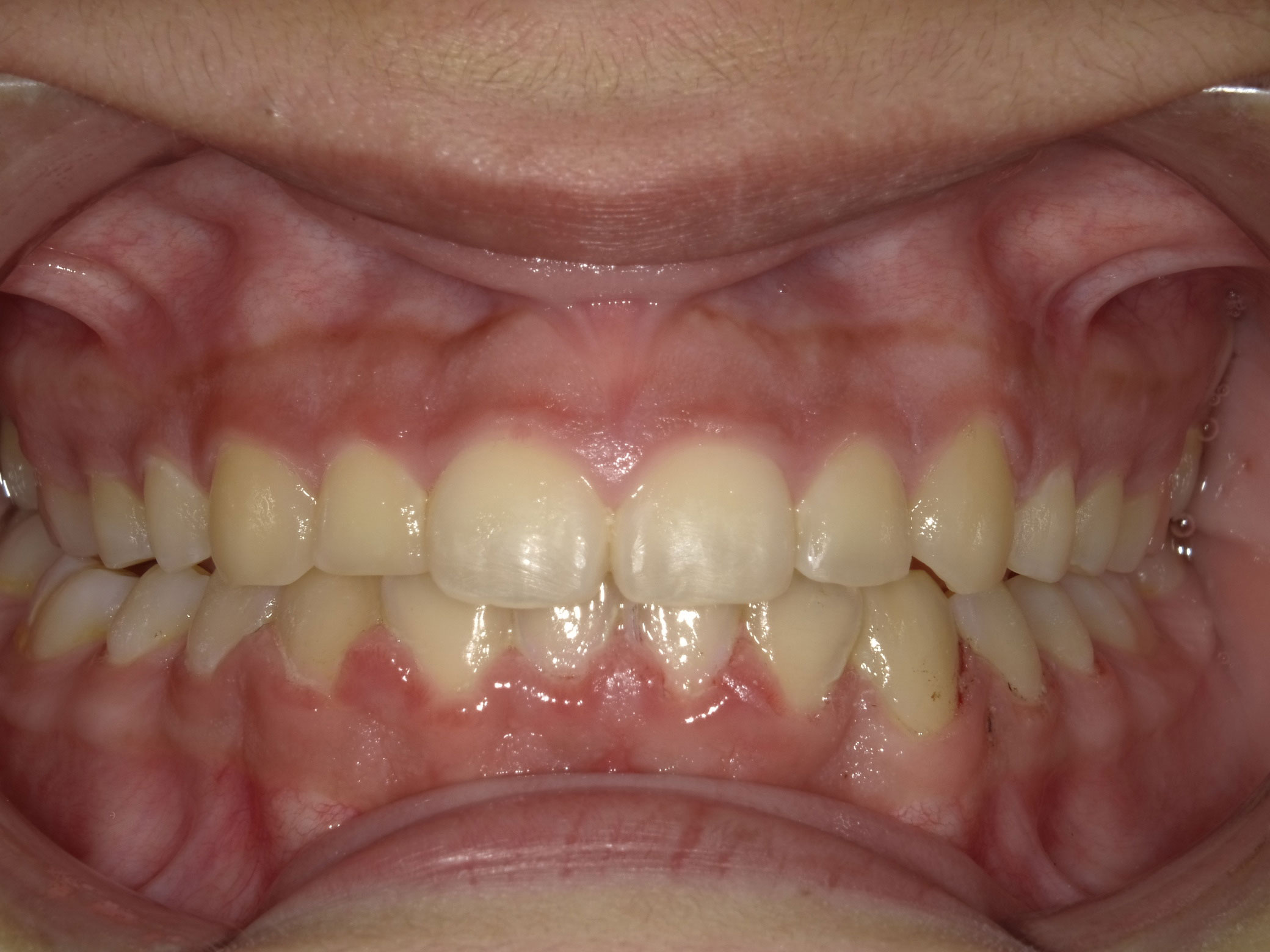 New Image Orthodontics | Dentures, Sleep Apnea and Dental Cleanings