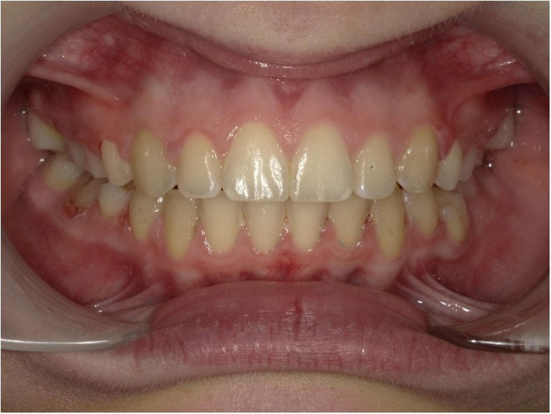 New Image Orthodontics | Dental Bridges, Sleep Apnea and Dental Cleanings