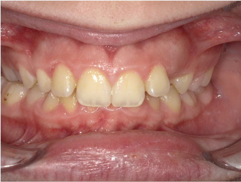 New Image Dental and Orthodontics | Dentures, Dental Fillings and Crowns
