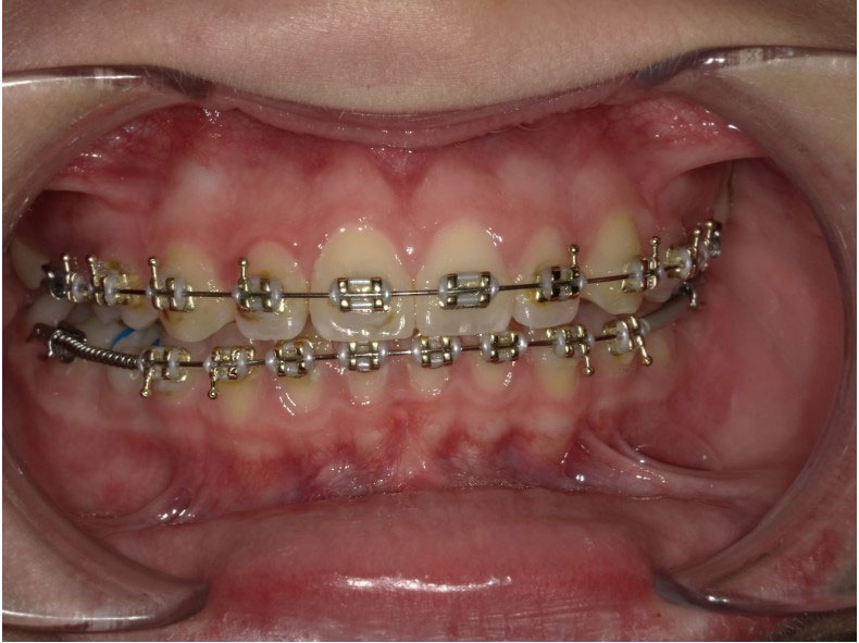 New Image Orthodontics | Dental Bridges, Dental Fillings and Dentures
