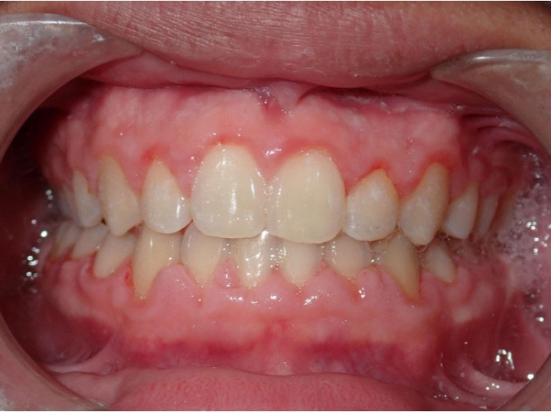 New Image Orthodontics | Teeth Whitening, Dental Cleanings and Sleep Apnea