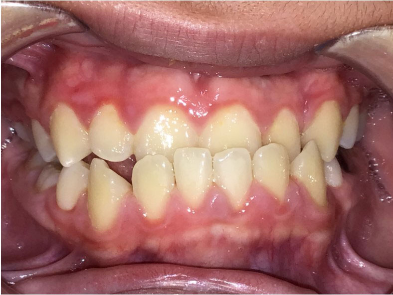 New Image Orthodontics | Dental Bridges, Dental Cleanings and Oral Exams