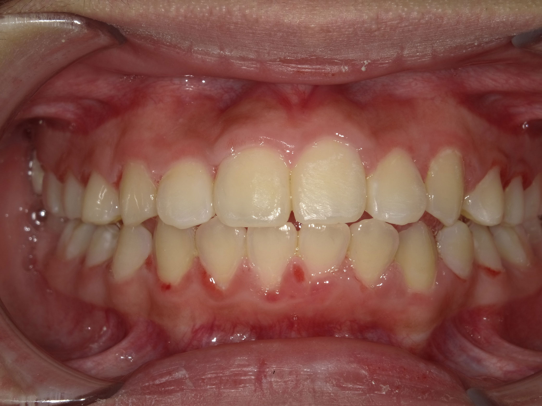 New Image Orthodontics | Oral Exams, Dental Bridges and Crowns