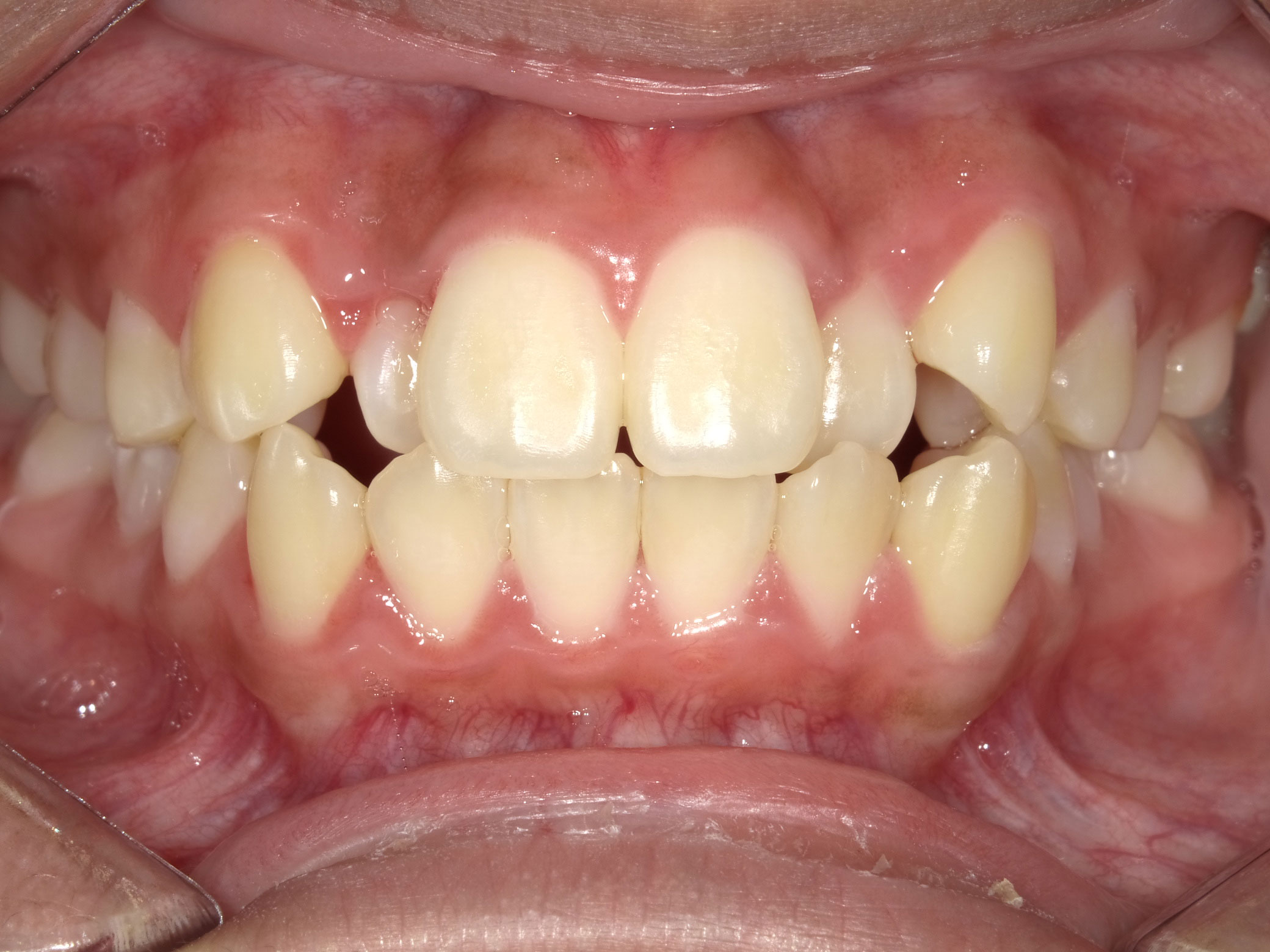 New Image Orthodontics | Dental Fillings, TMJ Disorders and Dentures