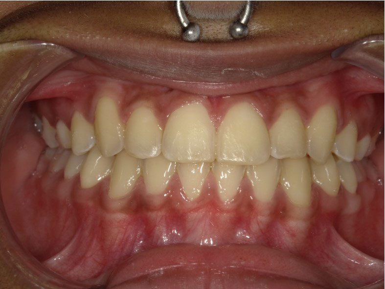 New Image Orthodontics | Oral Exams, Teeth Whitening and Sleep Apnea