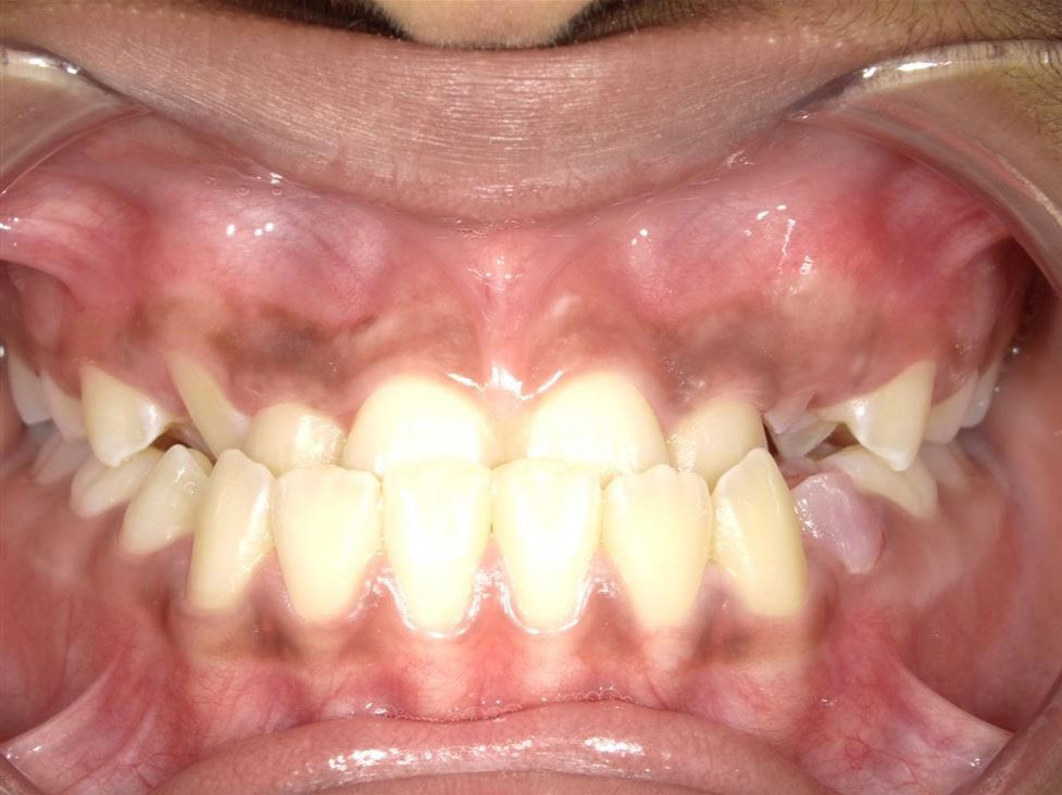 New Image Orthodontics | Teeth Whitening, Crowns and Dental Fillings