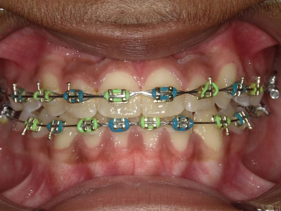 New Image Orthodontics | Dental Cleanings, Dental Fillings and Oral Exams