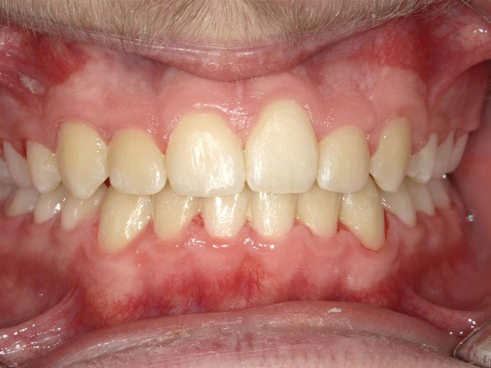 New Image Orthodontics | Oral Exams, Teeth Whitening and Dental Fillings