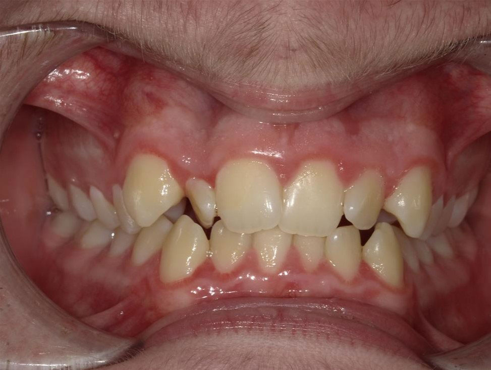 New Image Orthodontics | Teeth Whitening, Sleep Apnea and Dental Fillings