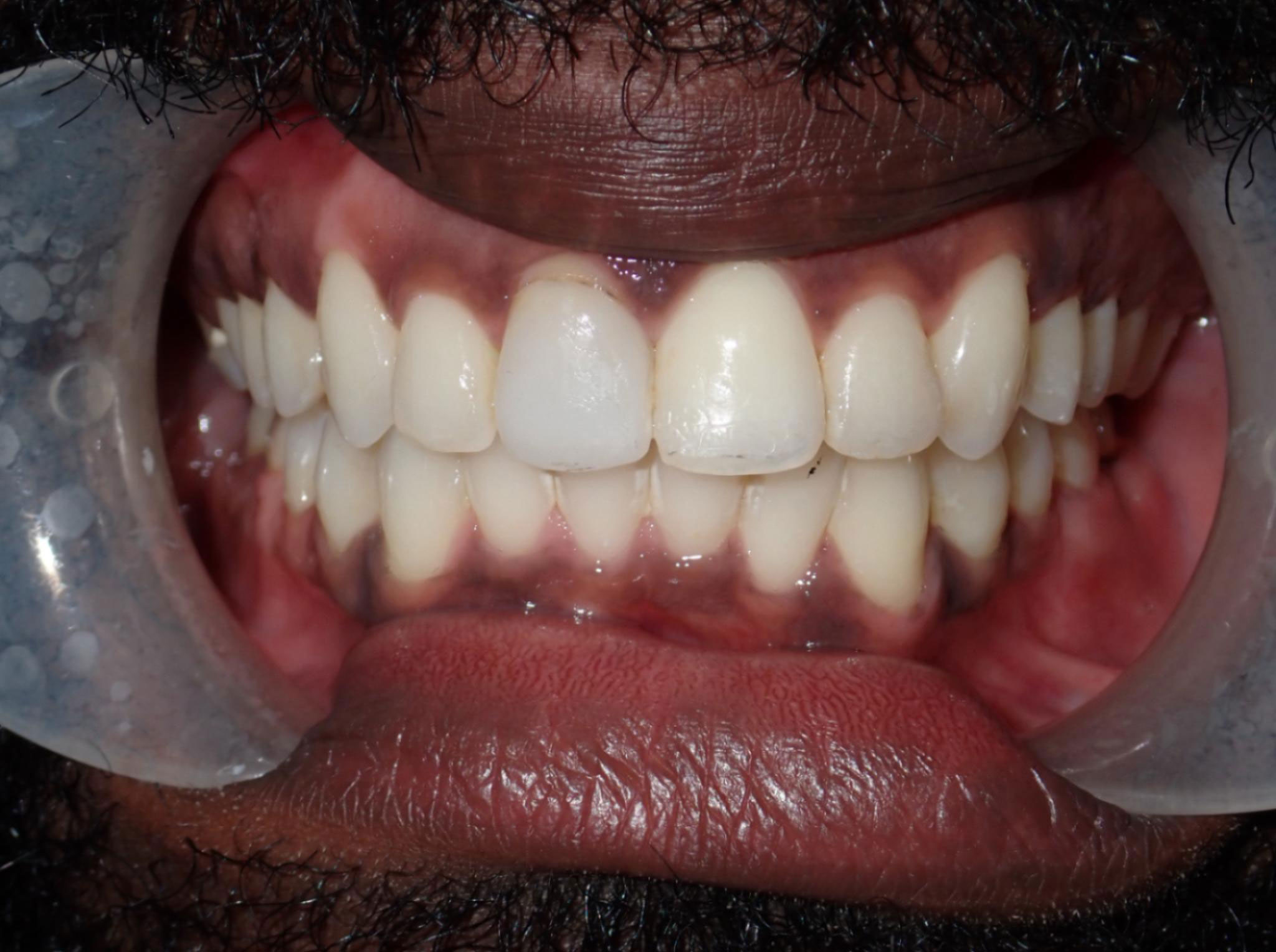 New Image Orthodontics | Oral Exams, Dental Bridges and Teeth Whitening