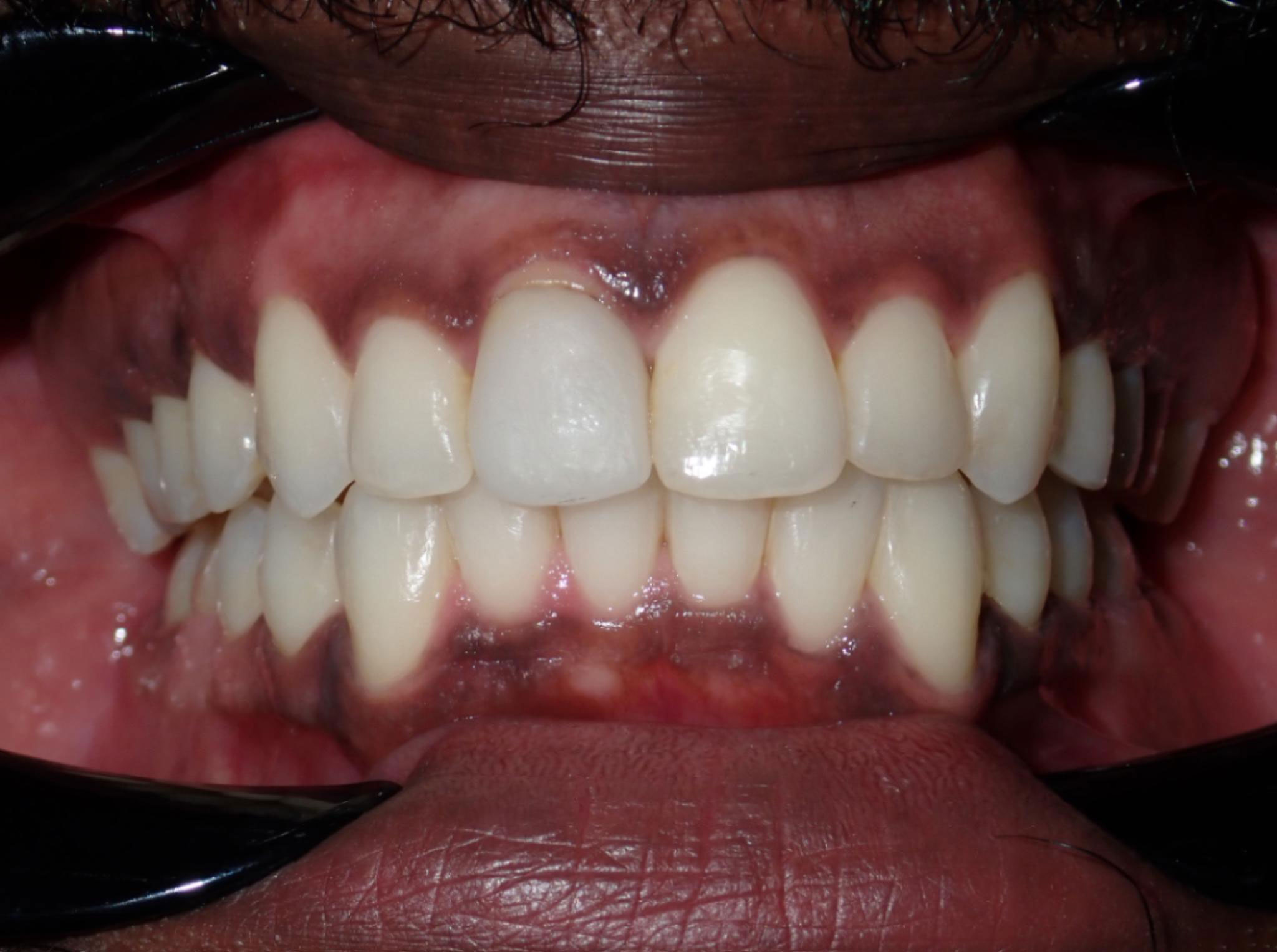 New Image Orthodontics | Dentures, TMJ Disorders and Dental Fillings