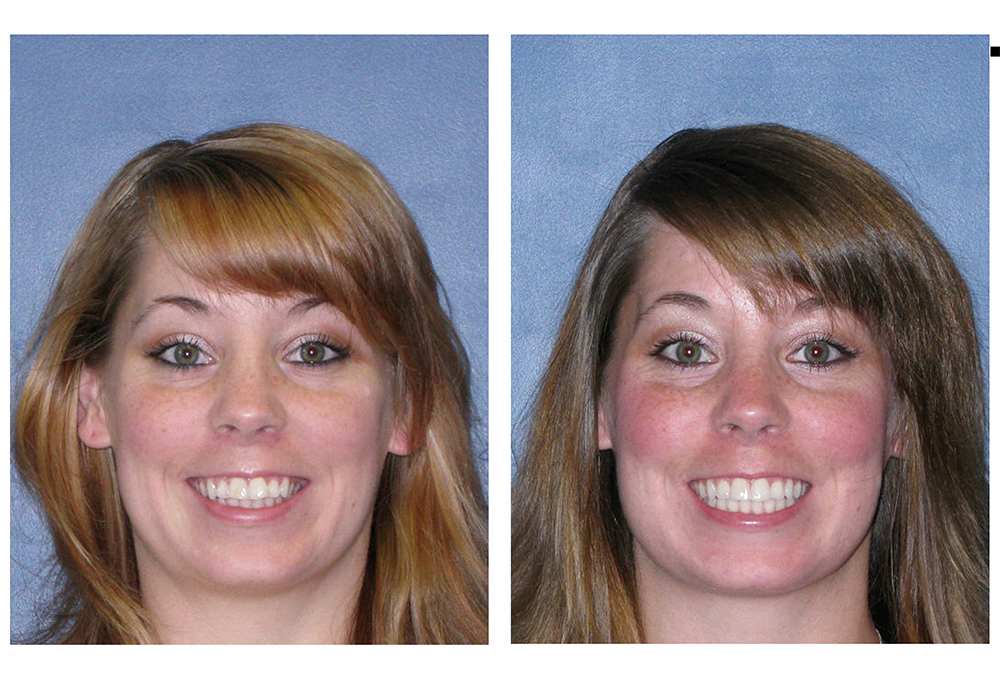 New Image Orthodontics