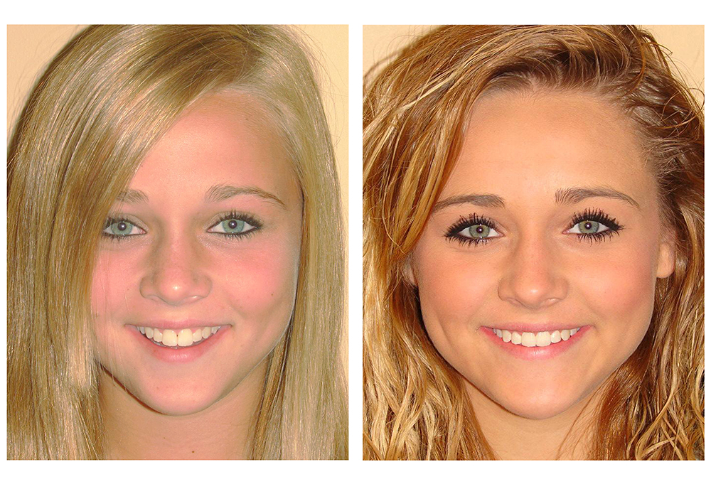 New Image Orthodontics