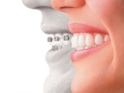 New Image Dental and Orthodontics | Dental Cleanings, TMJ Disorders and Oral Exams