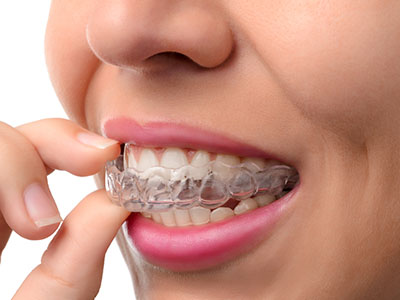 New Image Dental and Orthodontics | Crowns, TMJ Disorders and Dentures