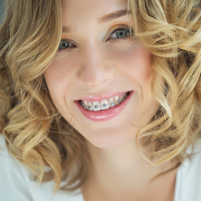 New Image Orthodontics | Oral Exams, Dental Bridges and Crowns
