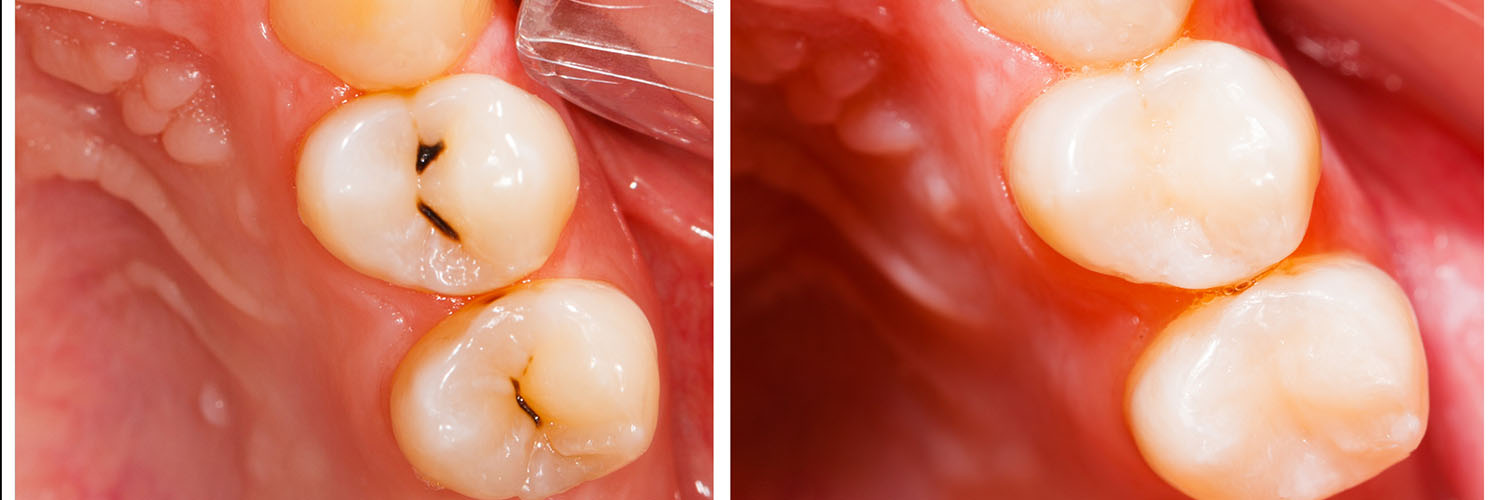 New Image Orthodontics